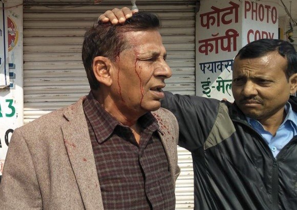 जनकपुरमा सरकारको निर्मम दमन, रगतको धारा बग्यो नेताको टाउकोबाट